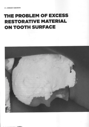 The problem of excess restorative material on tooth surface